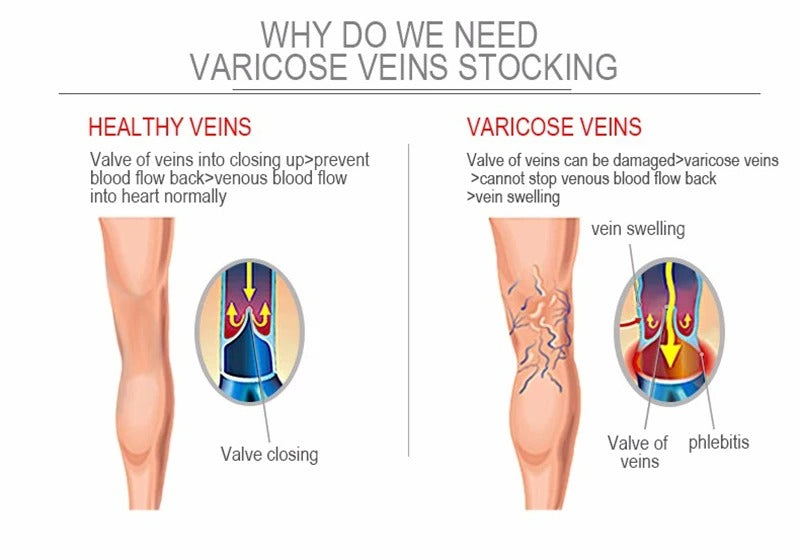 Premium Compression Support Stockings for Varicose Veins – Below Knee Circulation Socks for Pain Relief, Muscle Support & Comfort – Breathable Nylon/Spandex – Black/Nude – S-M, L-XL, XXL