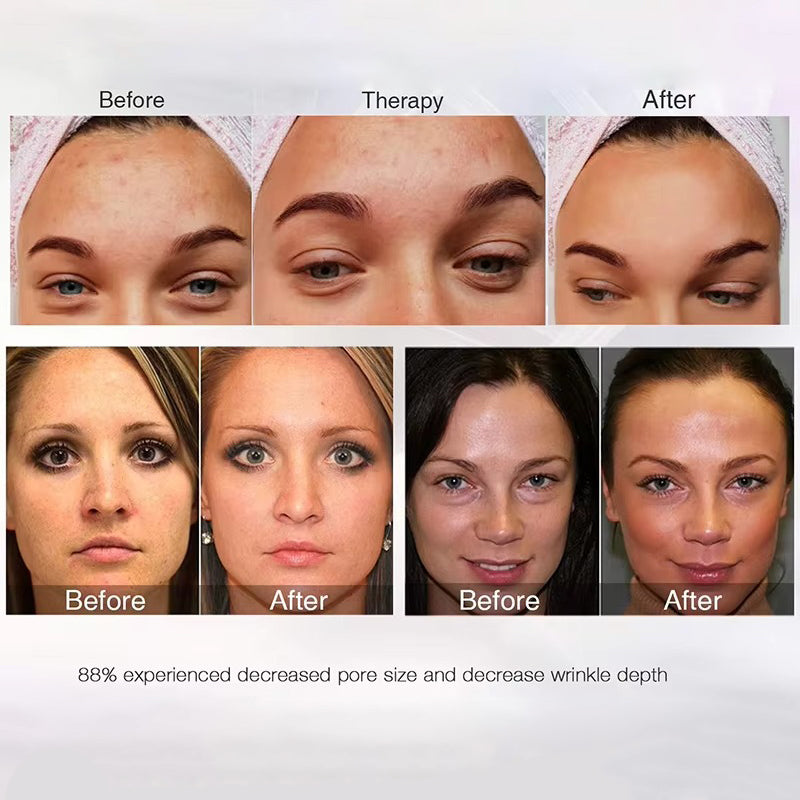 Premium LED Facial and Neck Rejuvenation Machine – Skin Rejuvenation Massager for Anti-Aging, Wrinkle Reduction, and Skin Tightening with Advanced Light Therapy