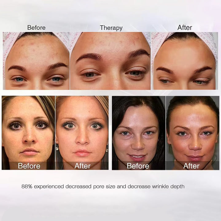 Premium LED Facial and Neck Rejuvenation Machine – Skin Rejuvenation Massager for Anti-Aging, Wrinkle Reduction, and Skin Tightening with Advanced Light Therapy