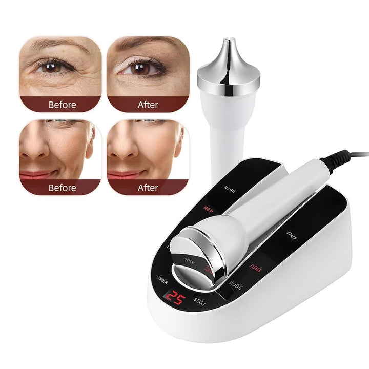 Premium Ultrasound Beauty Machine – High Frequency Face and Eye Massager for Skin Care, Facial Lifting, and SPA-Grade Ultrasonic Cleansing Device